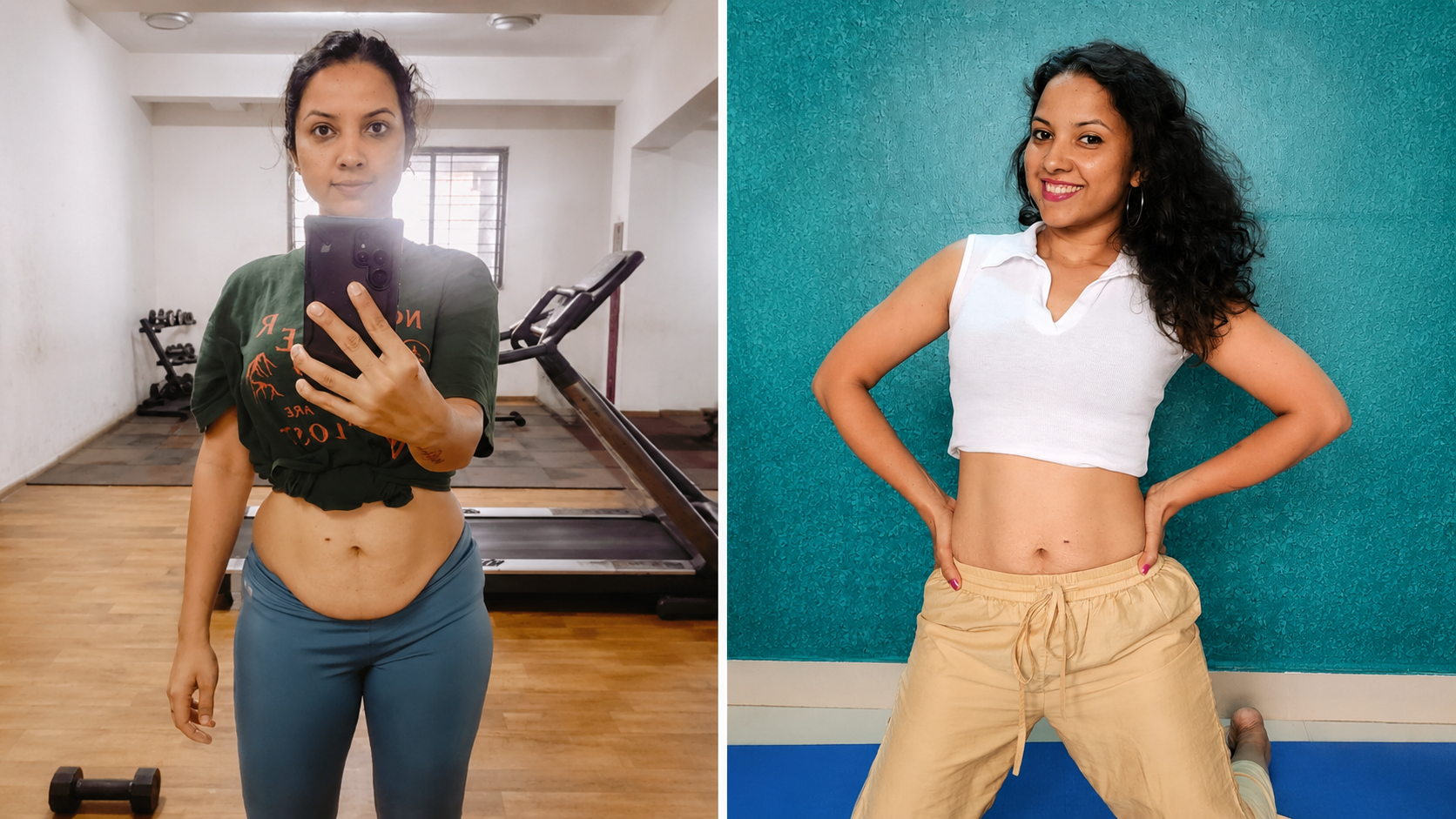 Diastasis Recti Correction v2